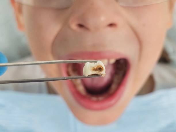 Best Urgent Dental Care  in Buckhorn, CA