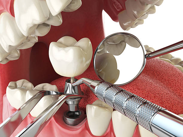 Best Emergency Gum Pain Relief  in Buckhorn, CA